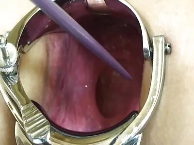 ಕಾಡು ಕತ್ತೆ ನೆಲದ ಮೇಲೆ ಕ್ರಮ